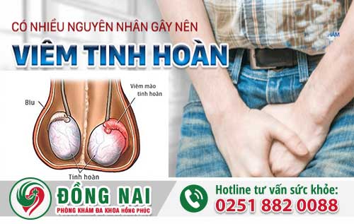 Nguyên Nhân Bệnh Viêm Mào Tinh Hoàn Ở Nam Giới